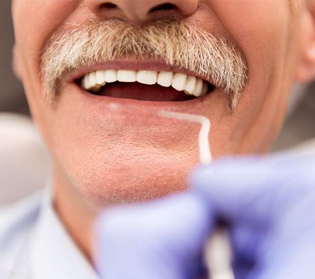 Grand Rapids Adjusting to New Dentures