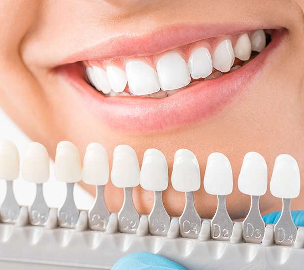 Grand Rapids Cosmetic Dentist