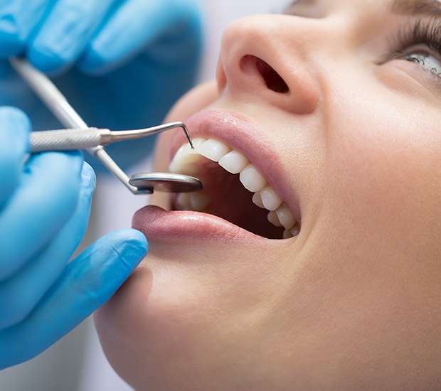 Grand Rapids Dental Bonding