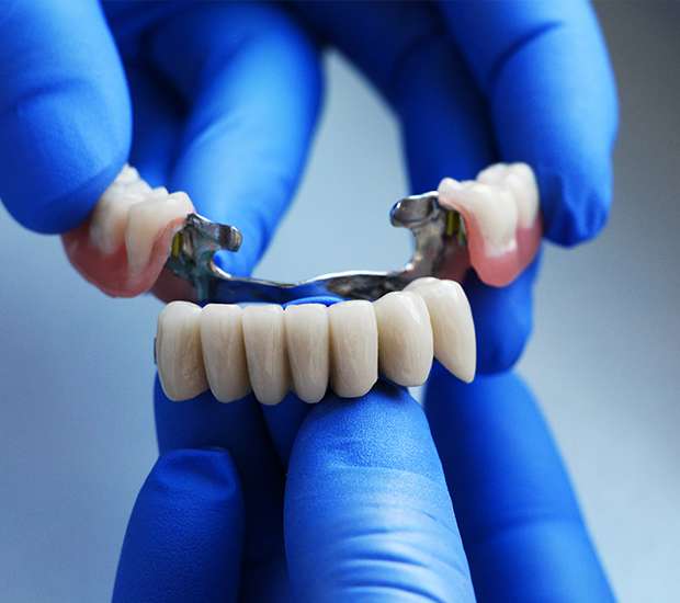 Grand Rapids Dental Bridges