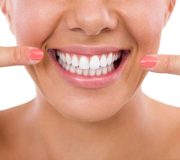 Grand Rapids What Is Gum Contouring and Reshaping