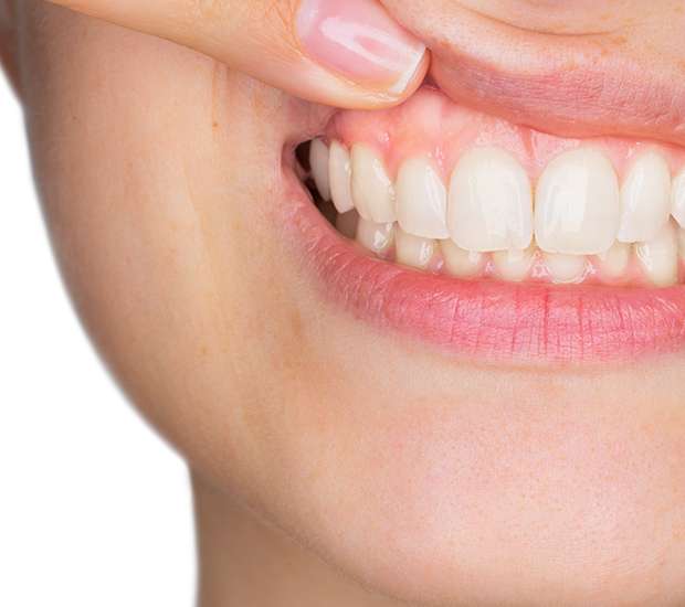 Grand Rapids Gum Disease