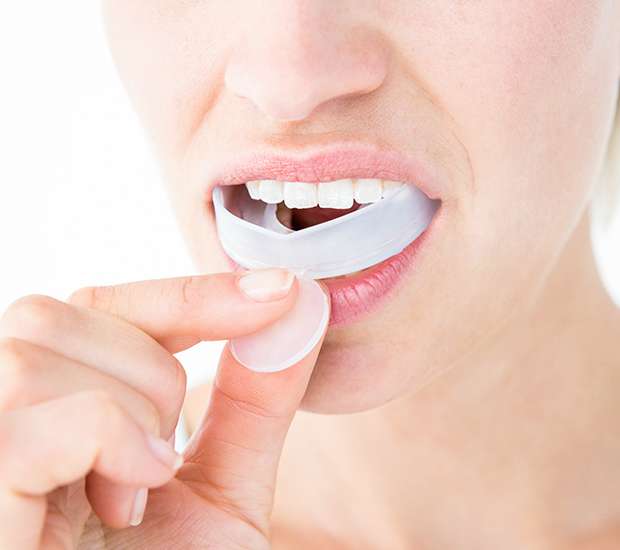 Grand Rapids Mouth Guards