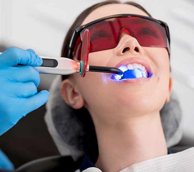 Grand Rapids Professional Teeth Whitening